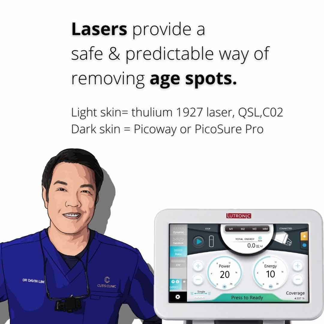 Laser-pigment-treatment