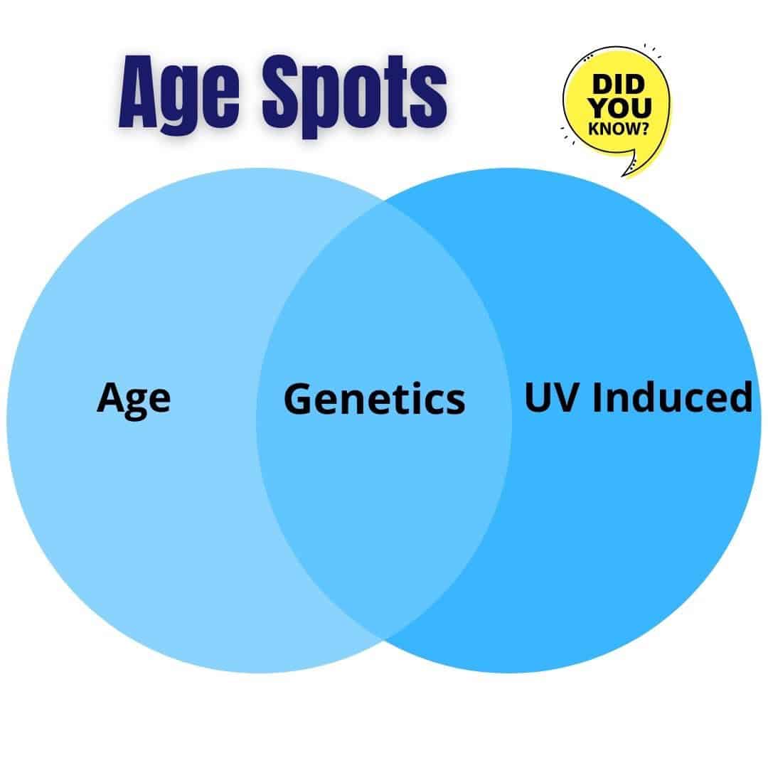 age-spot-treatment