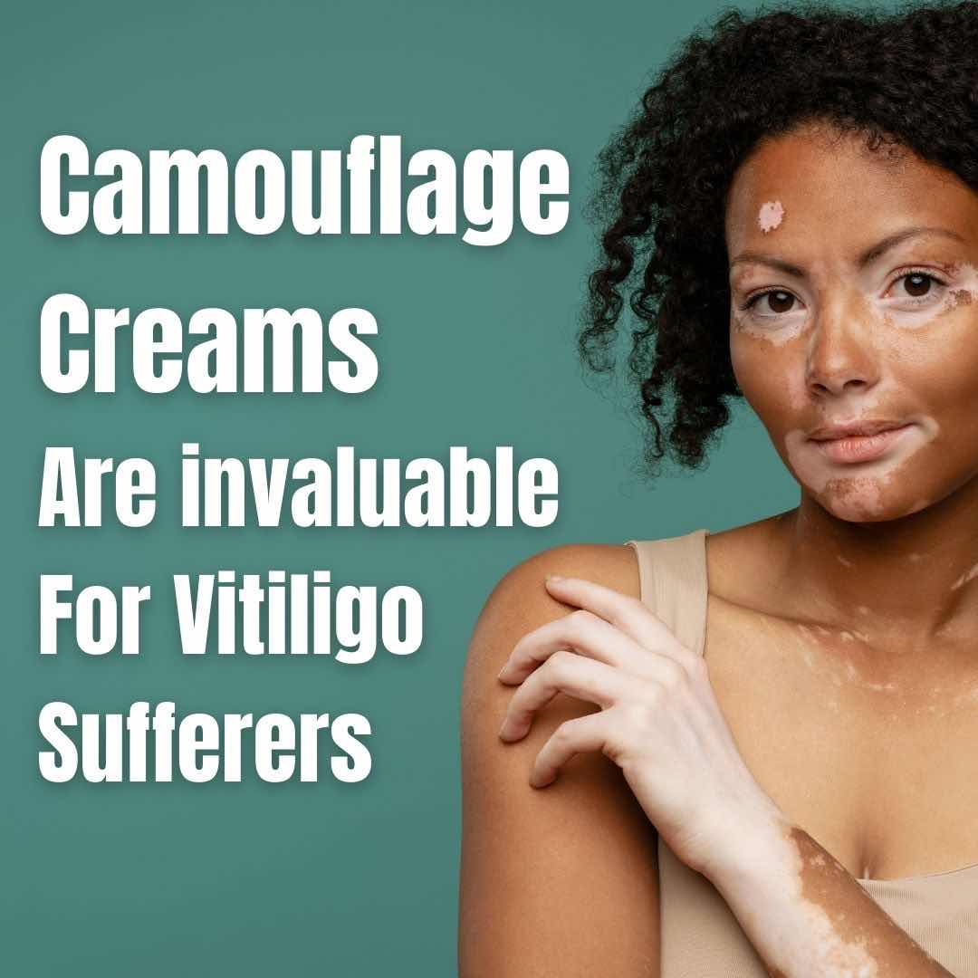 clinics-vitiligo-brisbane