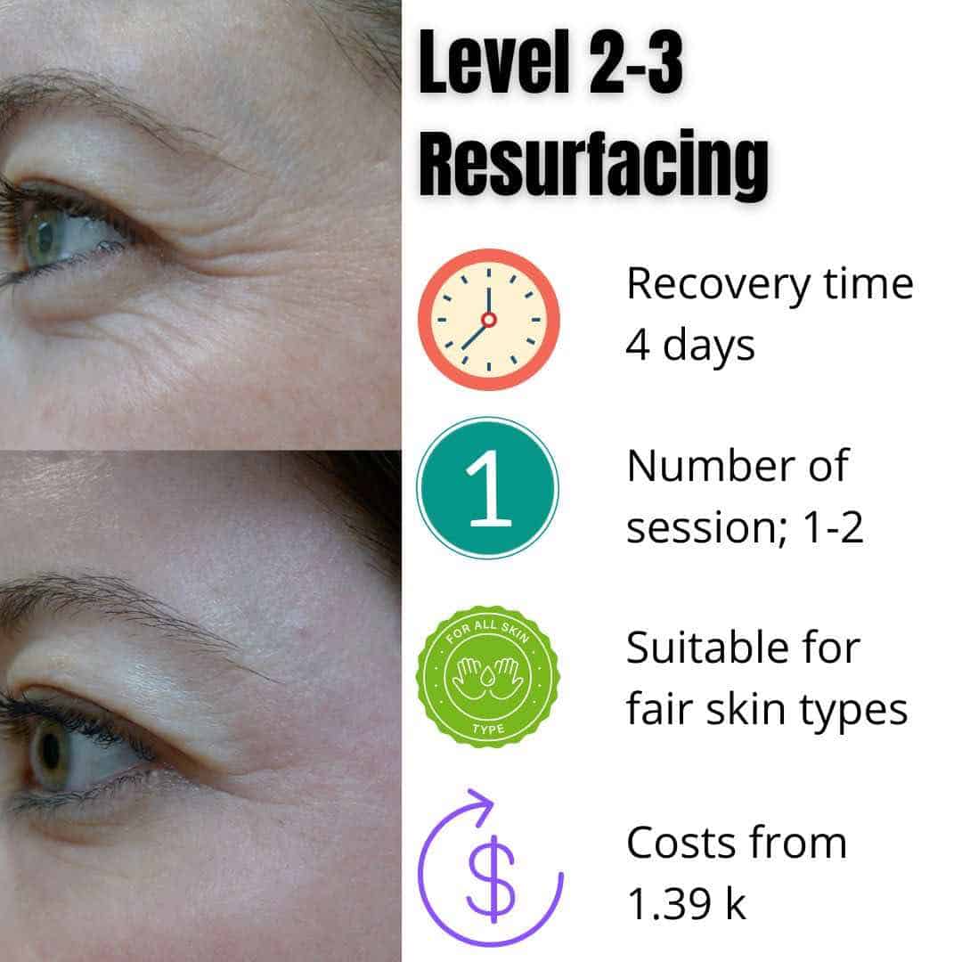 eye rejuvenation, laser