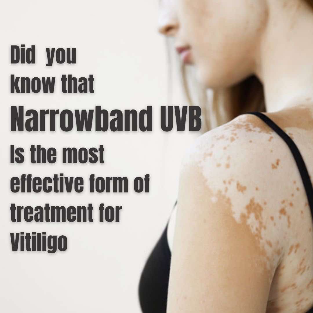 Vitiligo-clinics-brisbane