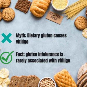 Vitiligo Natural Remedies, gluten-free-vitiligo-cure