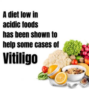 vitiligo-diet