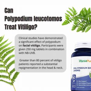 vitiligo-polypodium-remedy