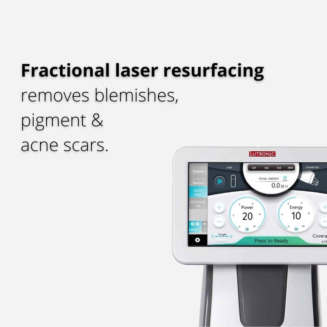 fractional-lasers