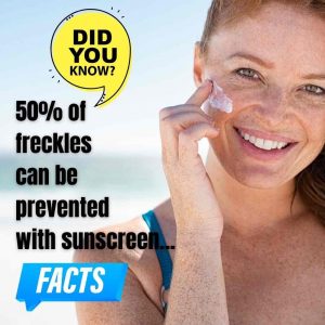 freckle-removal-gold-coast
