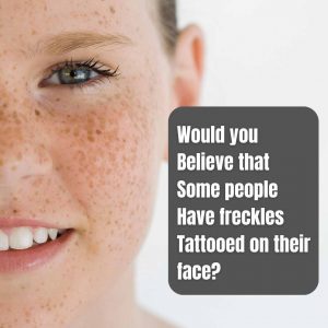 Freckle-treatment-Toowoomba 