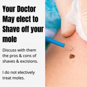 mole-laser-surgery