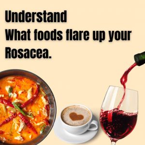 rosacea-diet