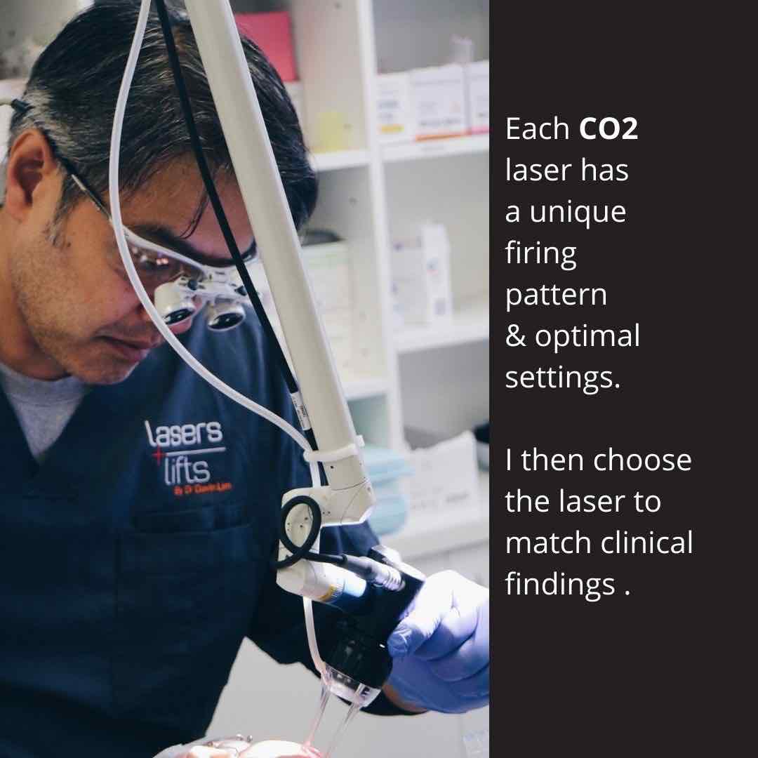 Co2 Laser Resurfacing Near Me A Rejuvenating Solution for Your Skin Concerns