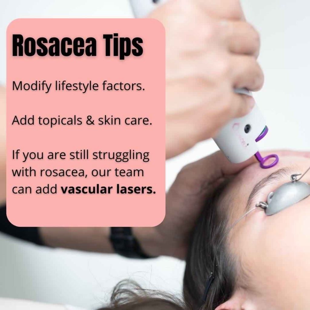 Best Rosacea Lasers In Australia Dr Davin Lim