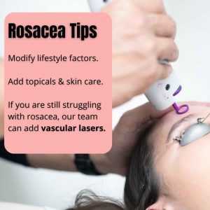 best-rosacea-dermatologist