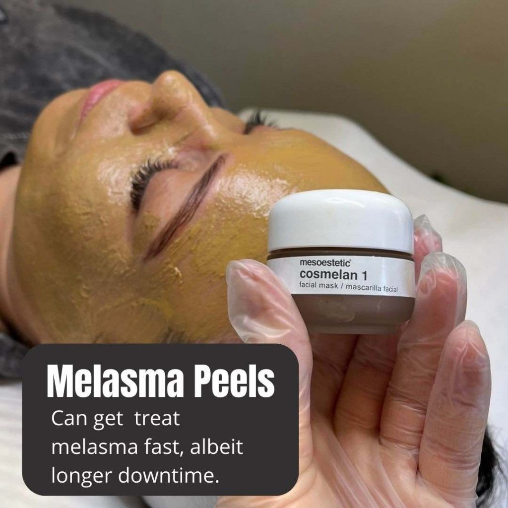 Best Dermamelan Peel Treatment In Brisbane Dr Davin Lim