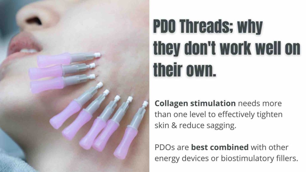 Best PDO Threads In Australia | Dr Davin Lim
