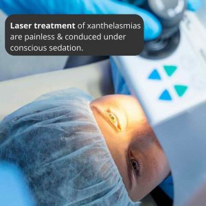 laser-removal-xanthelasma