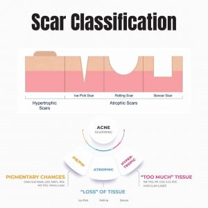scar-classification