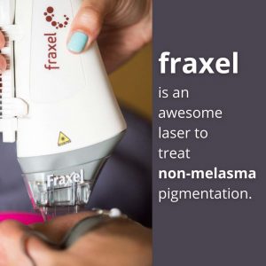 melamsa-treatment-fraxel
