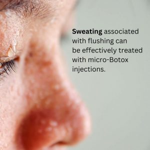 facial-sweating-treatments