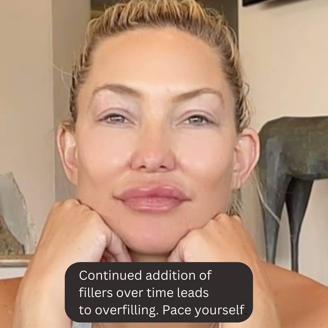 Dermal Fillers, Side Effects Dr Davin Lim