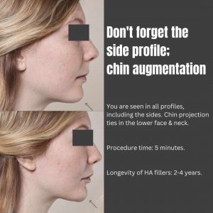 chin-augmentation-plastic-surgery