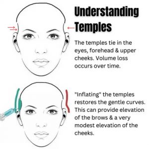 temple-dermal-filler