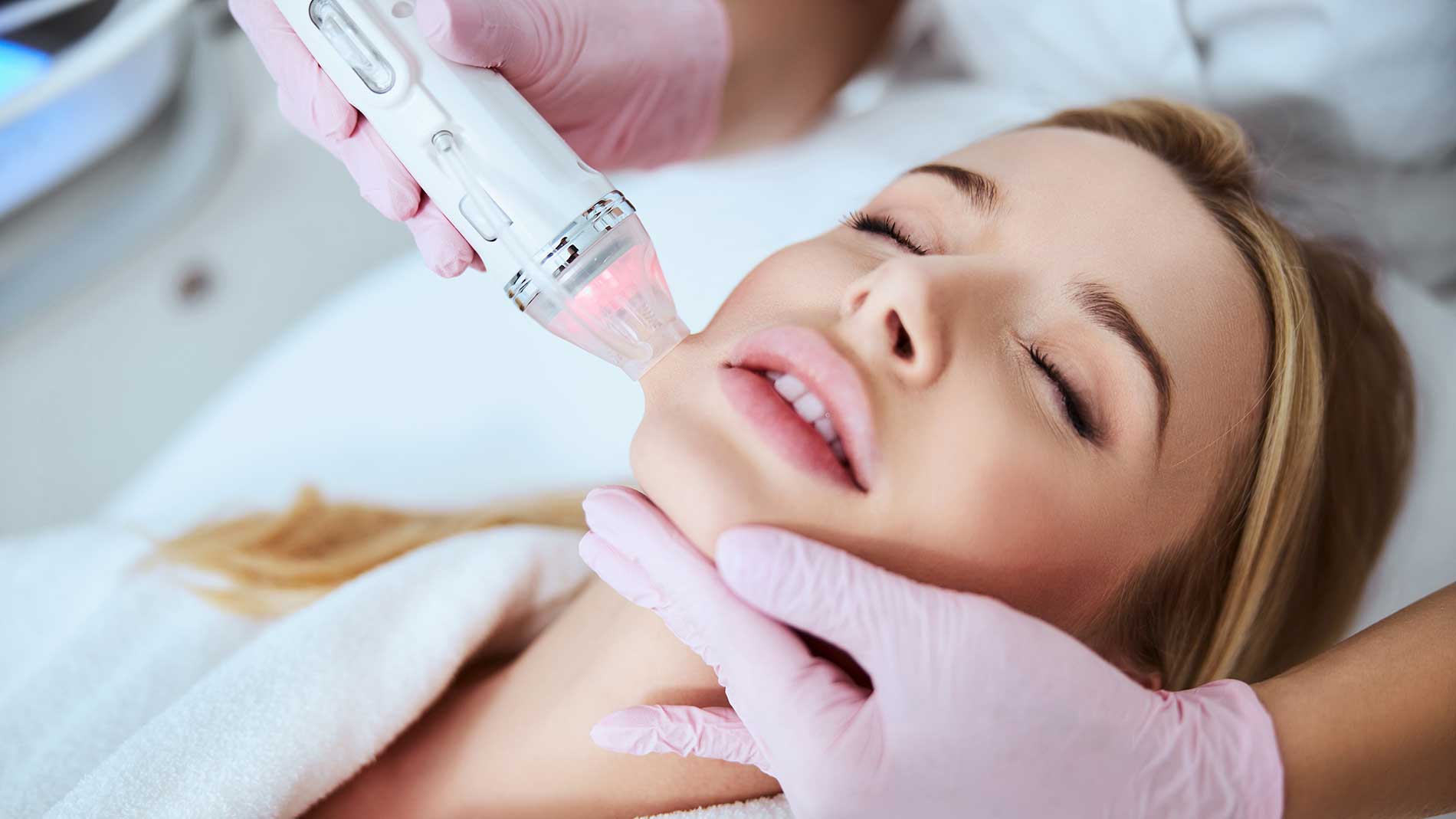 what can microneedling do for my skin