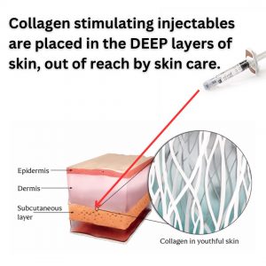 collagen stimulation biostimulators vs skin care