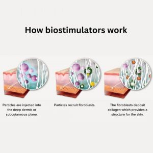 how biostimulators work